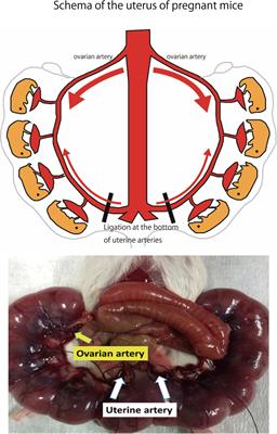 Relationship Between Short Term Variability (STV) and Onset of Cerebral Hemorrhage at Ischemia–Reperfusion Load in Fetal Growth Restricted (FGR) Mice